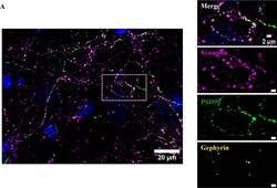 Invitrogen Donkey anti-Mouse IgG (H+L) Highly Cross-Adsorbed Secondary