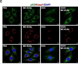Invitrogen Goat anti-Rabbit IgG (H+L) Highly Cross-Adsorbed Secondary Antibody,