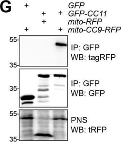 Invitrogen Goat anti-Rabbit IgG (H+L) Cross-Adsorbed Secondary Antibody,
