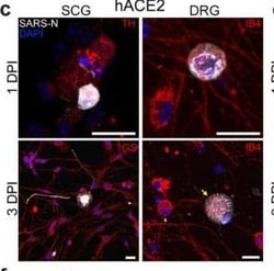 Invitrogen Goat anti-Mouse IgG (H+L) Cross-Adsorbed Secondary Antibody,