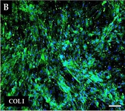 Invitrogen Goat anti-Rabbit IgG (H+L) Cross-Adsorbed Secondary Antibody,