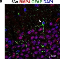 Invitrogen Goat anti-Chicken IgY (H+L) Secondary Antibody, Alexa Fluor