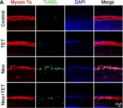 Invitrogen Goat anti-Rabbit IgG (H+L) Highly Cross-Adsorbed Secondary Antibody,