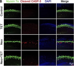 Invitrogen Goat anti-Rabbit IgG (H+L) Highly Cross-Adsorbed Secondary Antibody,