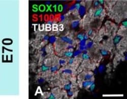 Invitrogen Goat anti-Mouse IgG2b Cross-Adsorbed Secondary Antibody, Alexa