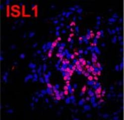 Invitrogen Goat anti-Rabbit IgG (H+L) Highly Cross-Adsorbed Secondary Antibody,
