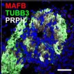 Invitrogen Goat anti-Rabbit IgG (H+L) Highly Cross-Adsorbed Secondary Antibody,