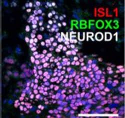 Invitrogen Goat anti-Rabbit IgG (H+L) Highly Cross-Adsorbed Secondary Antibody,