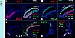 Invitrogen Goat anti-Rabbit IgG (H+L) Highly Cross-Adsorbed Secondary Antibody,