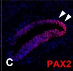 Invitrogen Goat anti-Rabbit IgG (H+L) Highly Cross-Adsorbed Secondary Antibody,