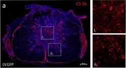 Invitrogen Goat anti-Mouse IgM (Heavy chain) Cross-Adsorbed Secondary Antibody, Alexa Fluor 568 500 &mu;g | Buy Online | Invitrogen&trade; | Fisher Scientific