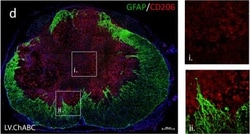 Invitrogen Donkey anti-Rabbit IgG (H+L) Highly Cross-Adsorbed Secondary