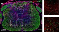 Invitrogen Donkey anti-Rabbit IgG (H+L) Highly Cross-Adsorbed Secondary