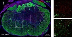Invitrogen Donkey anti-Rabbit IgG (H+L) Highly Cross-Adsorbed Secondary