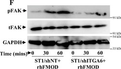 Invitrogen Goat anti-Rabbit IgG (H+L) Secondary Antibody, HRP 2 mL; HRP:Antikroppar
