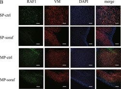 Invitrogen Goat anti-Mouse IgG (H+L) Highly Cross-Adsorbed Secondary Antibody,