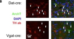 Invitrogen Goat anti-Rabbit IgG (H+L) Cross-Adsorbed Secondary Antibody,