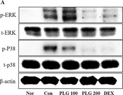 Invitrogen Goat anti-Rabbit IgG (H+L) Secondary Antibody, HRP 2 mL; HRP:Antikroppar