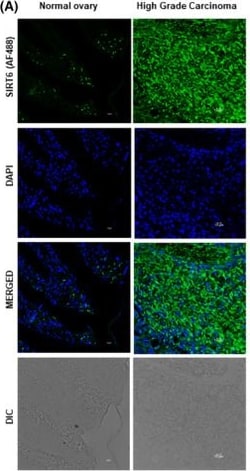 Invitrogen Goat anti-Rabbit IgG (H+L) Cross-Adsorbed Secondary Antibody,