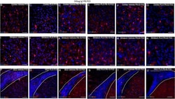 Invitrogen Goat anti-Rabbit IgG (H+L) Highly Cross-Adsorbed Secondary Antibody,