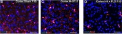 Invitrogen Goat anti-Rabbit IgG (H+L) Highly Cross-Adsorbed Secondary Antibody,