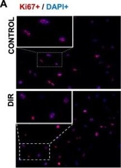 Invitrogen Goat anti-Rabbit IgG (H+L) Cross-Adsorbed Secondary Antibody,
