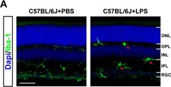 Invitrogen Donkey anti-Rabbit IgG (H+L) Highly Cross-Adsorbed Secondary