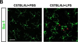 Invitrogen Donkey anti-Rabbit IgG (H+L) Highly Cross-Adsorbed Secondary