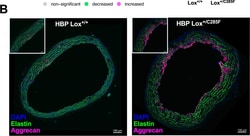 Invitrogen Donkey anti-Rabbit IgG (H+L) Highly Cross-Adsorbed Secondary