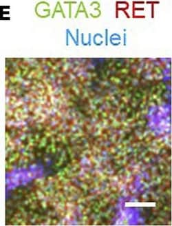 Invitrogen Donkey anti-Rabbit IgG (H+L) Highly Cross-Adsorbed Secondary