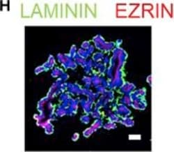 Invitrogen Donkey anti-Rabbit IgG (H+L) Highly Cross-Adsorbed Secondary