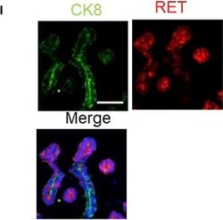 Invitrogen Donkey anti-Mouse IgG (H+L) Highly Cross-Adsorbed Secondary