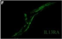Invitrogen Donkey anti-Rabbit IgG (H+L) Highly Cross-Adsorbed Secondary