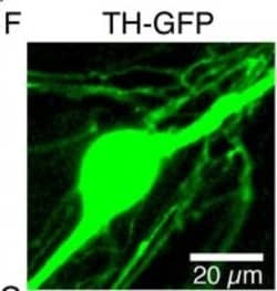 Invitrogen Goat anti-Rabbit IgG (H+L) Highly Cross-Adsorbed Secondary Antibody,