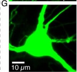 Invitrogen Goat anti-Rabbit IgG (H+L) Highly Cross-Adsorbed Secondary Antibody,