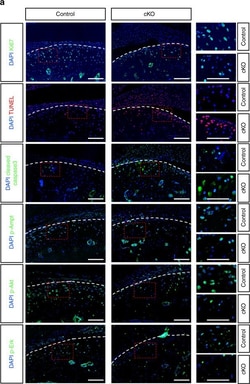Invitrogen Goat anti-Rabbit IgG (H+L) Cross-Adsorbed Secondary Antibody,
