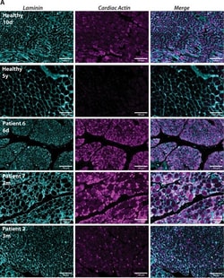Invitrogen Goat anti-Rabbit IgG (H+L) Highly Cross-Adsorbed Secondary Antibody,