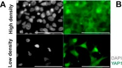 Invitrogen Goat anti-Mouse IgG (H+L) Cross-Adsorbed Secondary Antibody,