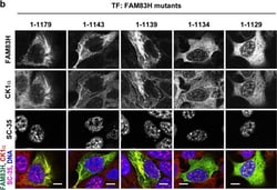 Invitrogen Donkey anti-Mouse IgG (H+L) Highly Cross-Adsorbed Secondary