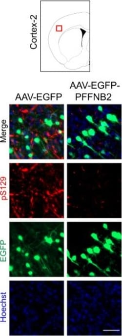 Invitrogen Goat anti-Rabbit IgG (H+L) Highly Cross-Adsorbed Secondary Antibody,