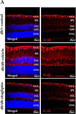 Invitrogen Goat anti-Rabbit IgG (H+L) Cross-Adsorbed Secondary Antibody,