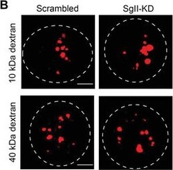Invitrogen Goat anti-Rabbit IgG (H+L) Highly Cross-Adsorbed Secondary Antibody,