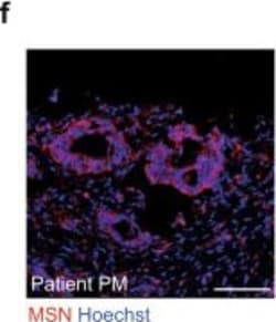 Invitrogen Goat anti-Rabbit IgG (H+L) Highly Cross-Adsorbed Secondary Antibody,