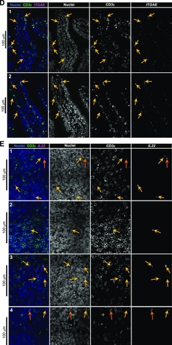 Invitrogen F(ab')2-Goat anti-Rabbit IgG (H+L) Cross-Adsorbed Secondary