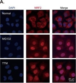 Invitrogen Donkey anti-Rabbit IgG (H+L) Highly Cross-Adsorbed Secondary