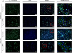 Invitrogen Goat anti-Rabbit IgG (H+L) Cross-Adsorbed Secondary Antibody,