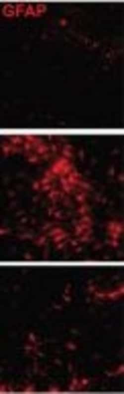 Invitrogen Donkey anti-Mouse IgG (H+L) Highly Cross-Adsorbed Secondary