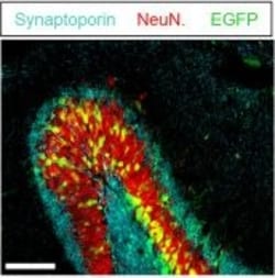 Invitrogen Donkey anti-Mouse IgG (H+L) Highly Cross-Adsorbed Secondary