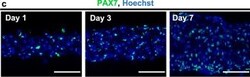 Invitrogen Goat anti-Rabbit IgG (H+L) Highly Cross-Adsorbed Secondary Antibody,