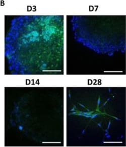 Invitrogen Donkey anti-Mouse IgG (H+L) Highly Cross-Adsorbed Secondary